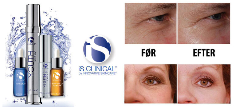 4033c9ad08b019300ac86152b028ebf6