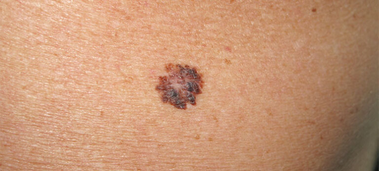 512016c780d006db76ffc096f7d13a34