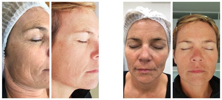 fb3bf6f8f43e9f01930161929cfa8fac